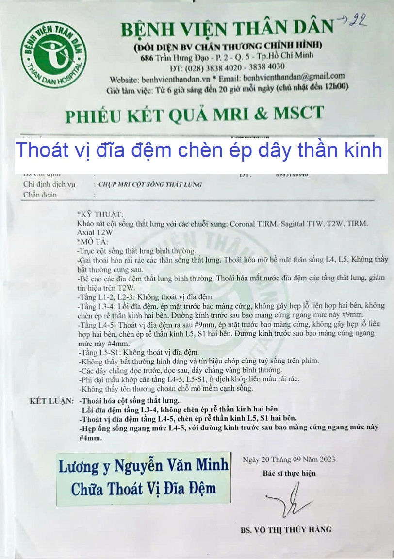 Thoát vị đĩa đệm chèn ép dây thần kinh